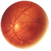 Retinal scan